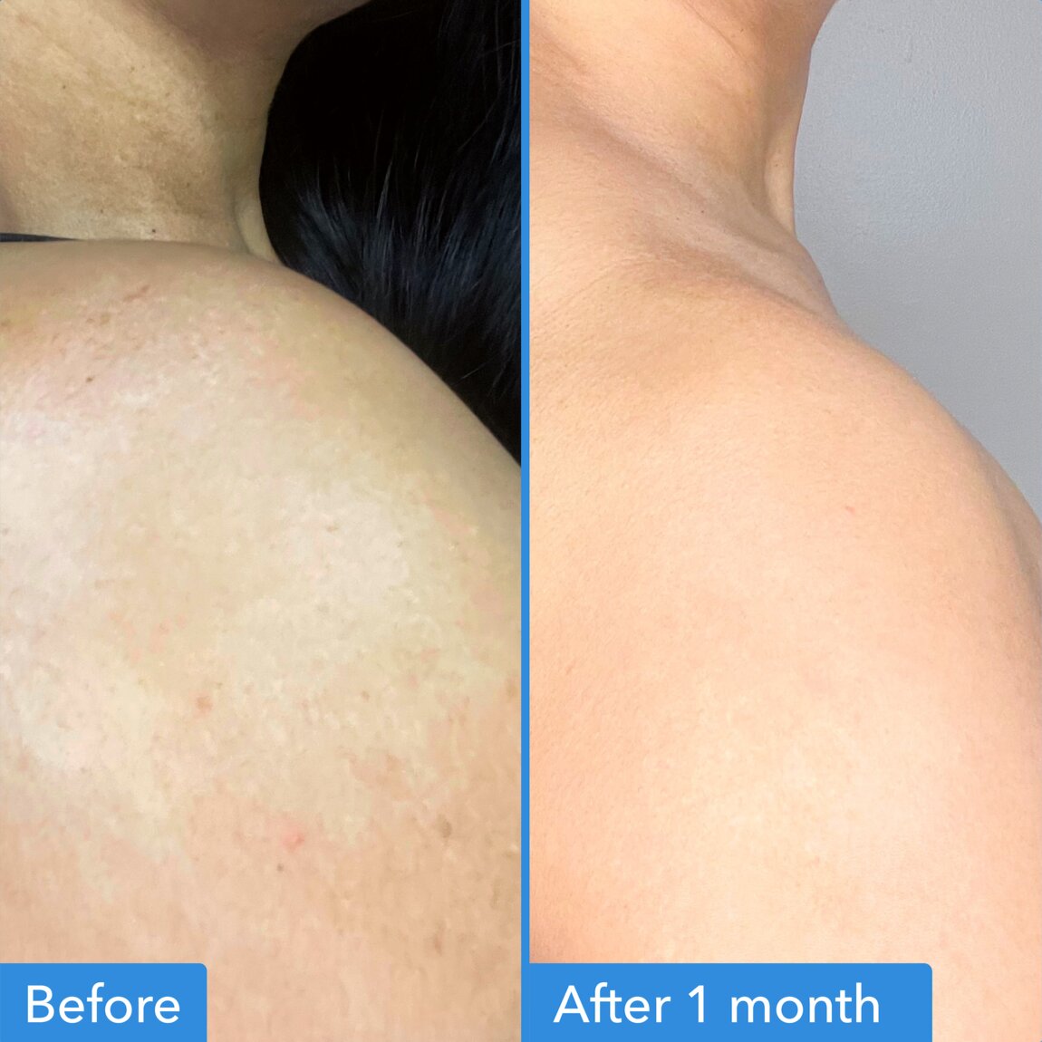 discoloration-correcting-body-treatment-d0 zb_p.jpg