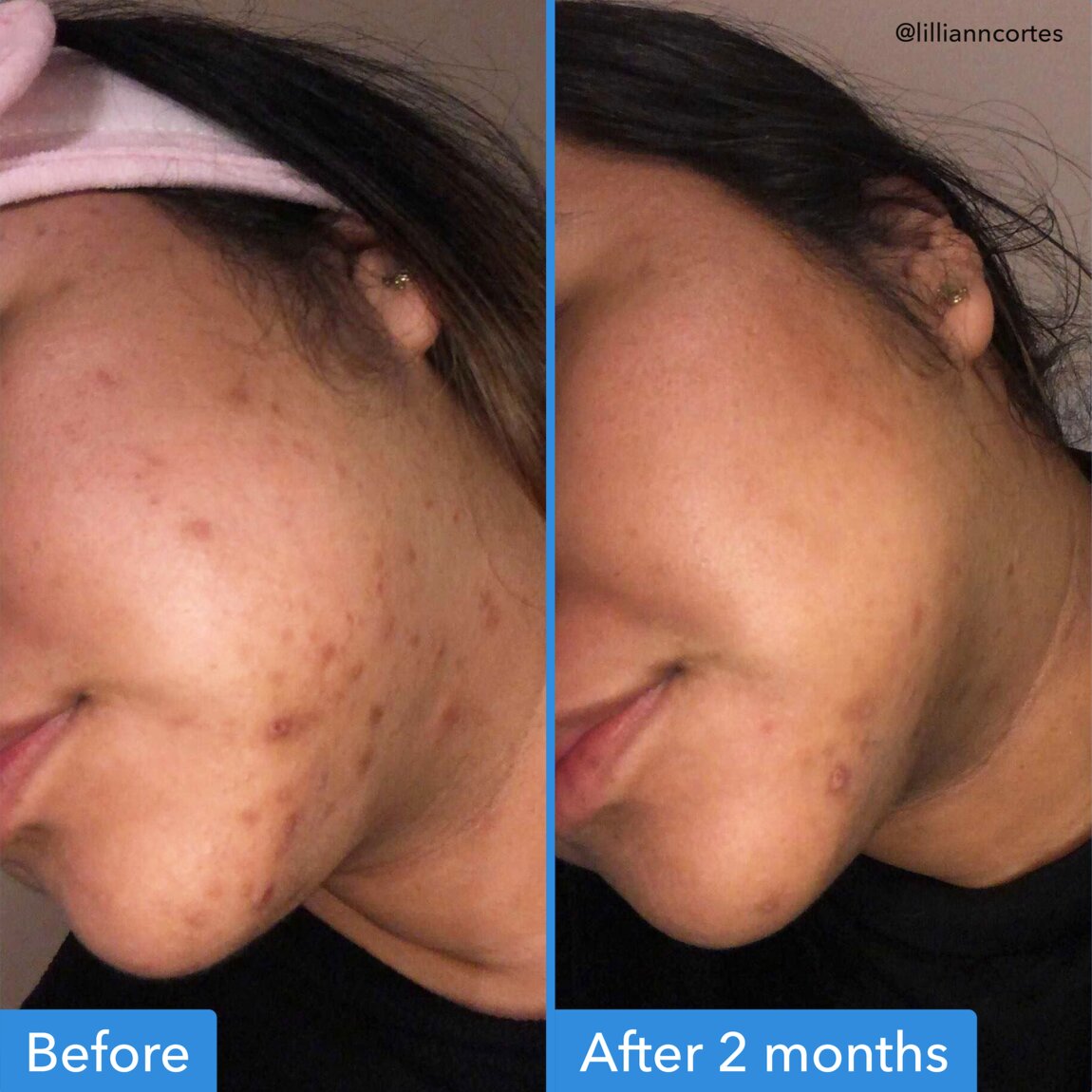 discoloration-correcting-serum-f3 zb_p.jpg
