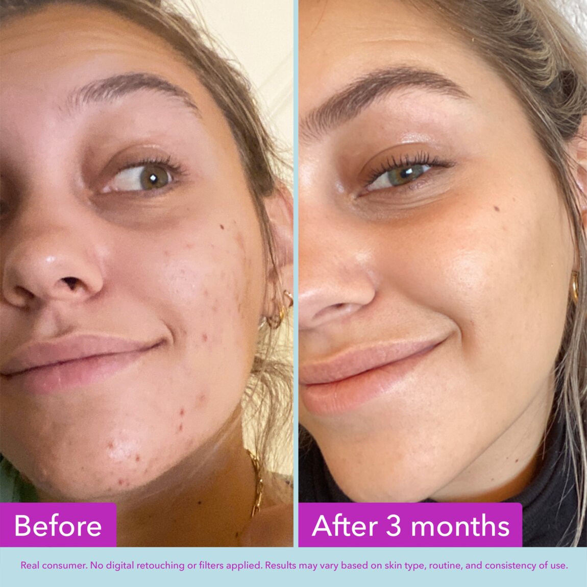 niacinamide-brightening-toner-s9 zb_p.jpg